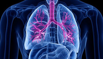 什么是慢性阻塞性肺病 (Chronic Obstructive Pulmonary Disease)，為何與新冠疫情有關？